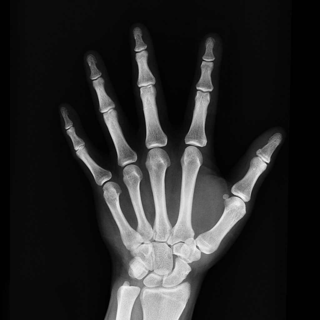 x-rays chiropractor greenville nc